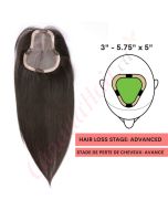 Black / Brown #1b Hair Topper 14 inch For Thinning Hair Part Large Coverage (Size: 3 inch - 5.75 inch x 5 inch, Weight: 60g) Remy Human Hair 